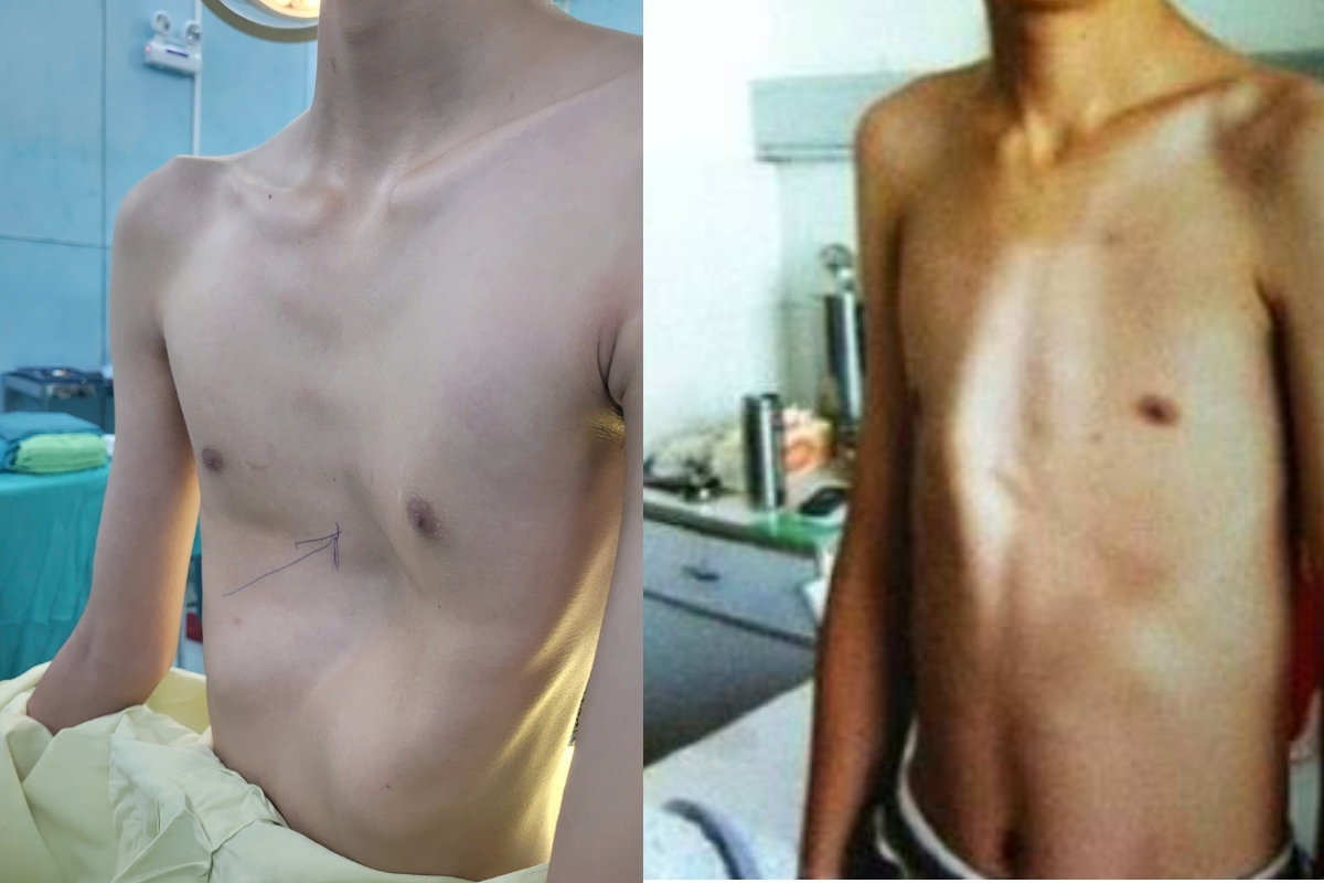 dạng dị tật thường gặp