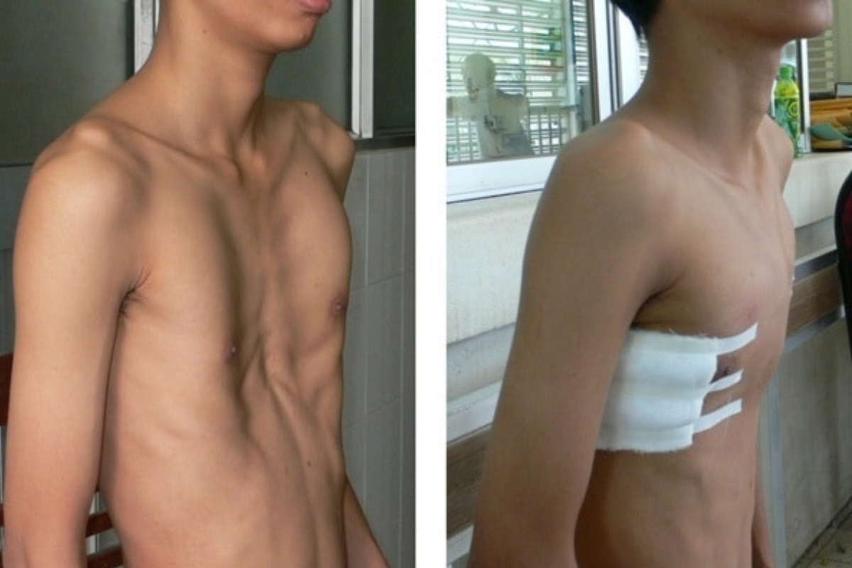 điều trị các bất thường hệ cơ xương