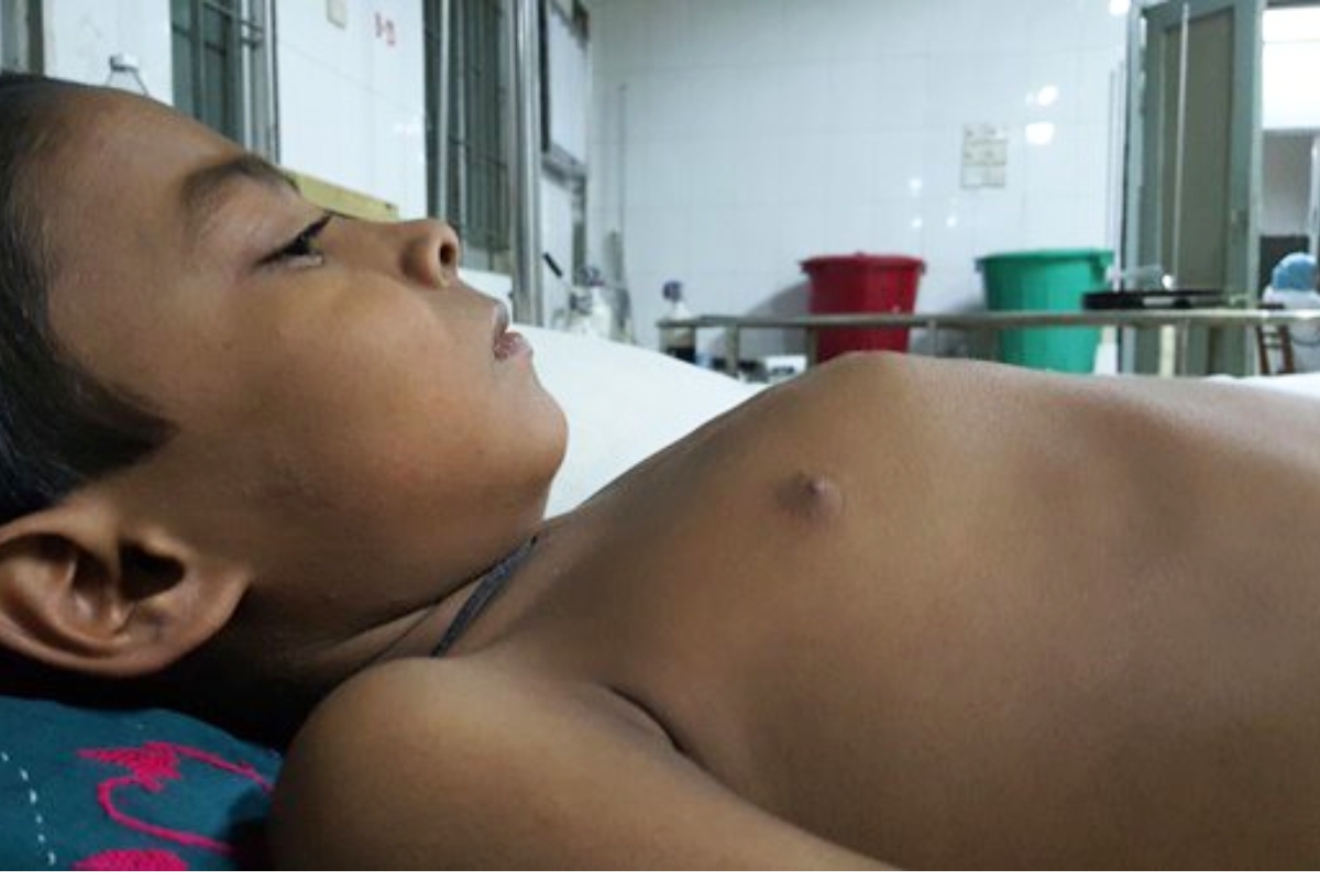 ngực ức gà có nguy hiểm không