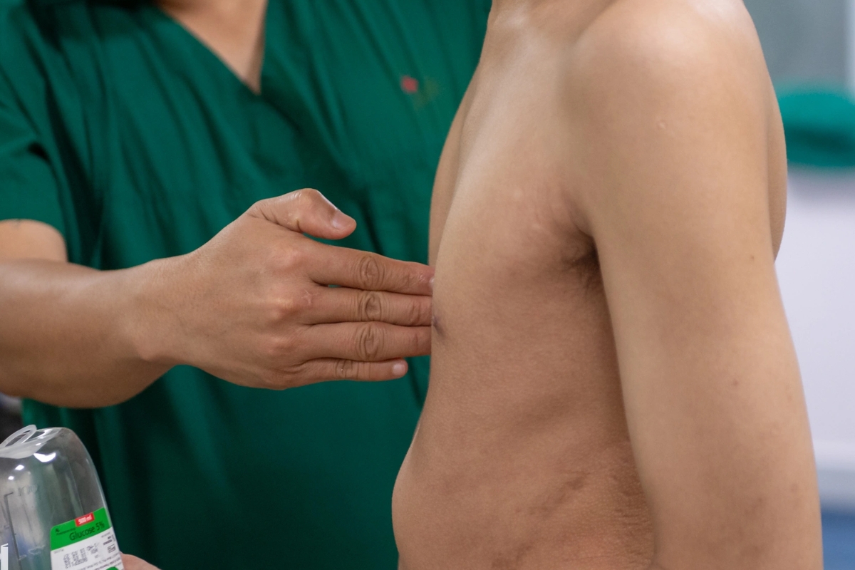 Nguyên nhân các dạng dị tật lồng ngực