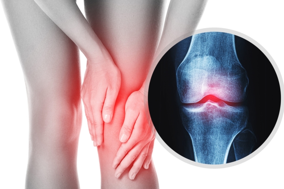 triệu chứng thoái hóa khớp gối