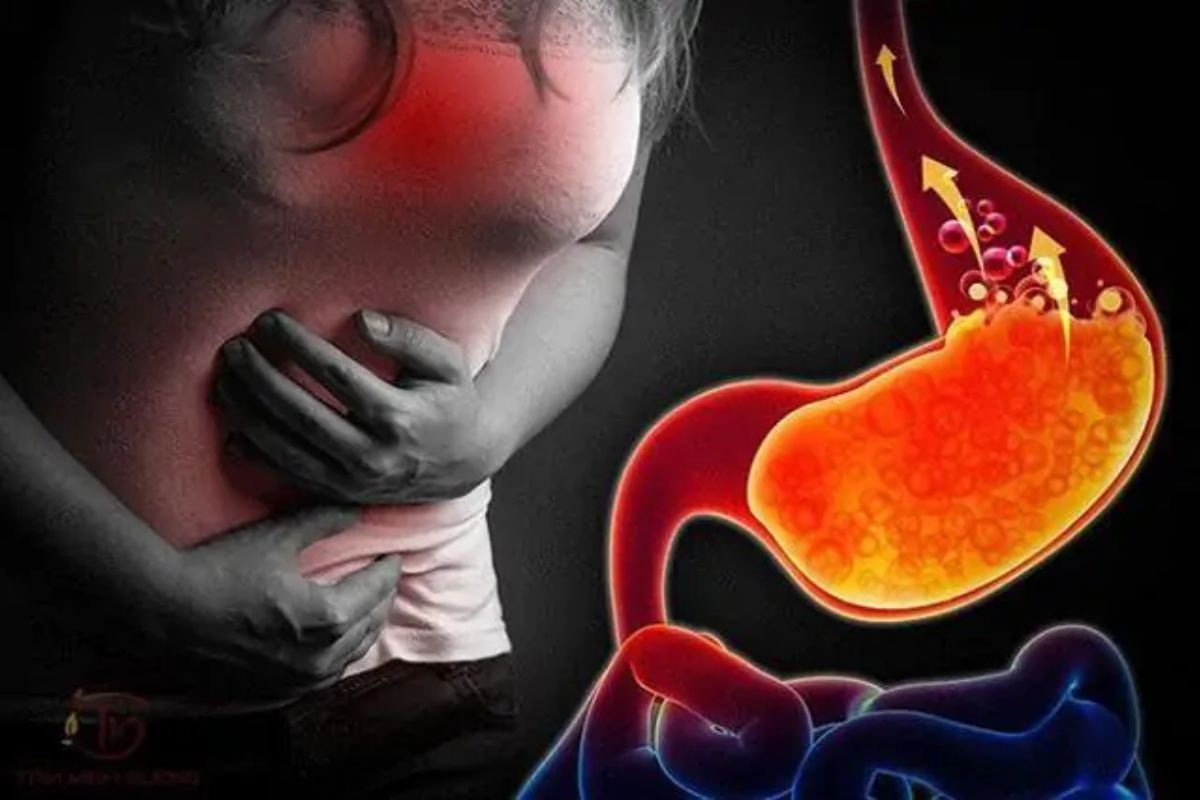 Trào ngược dạ dày có nguy hiểm không