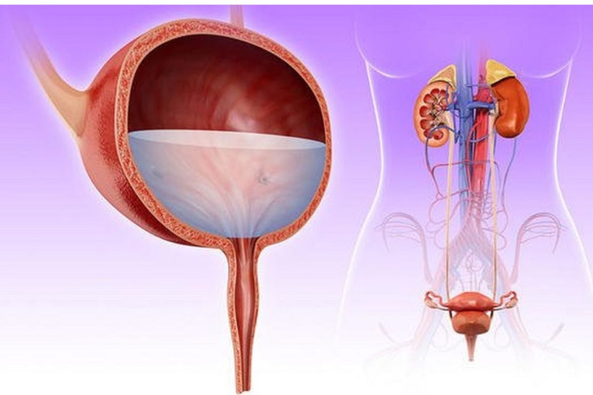 viêm đường tiết niệu là gì
