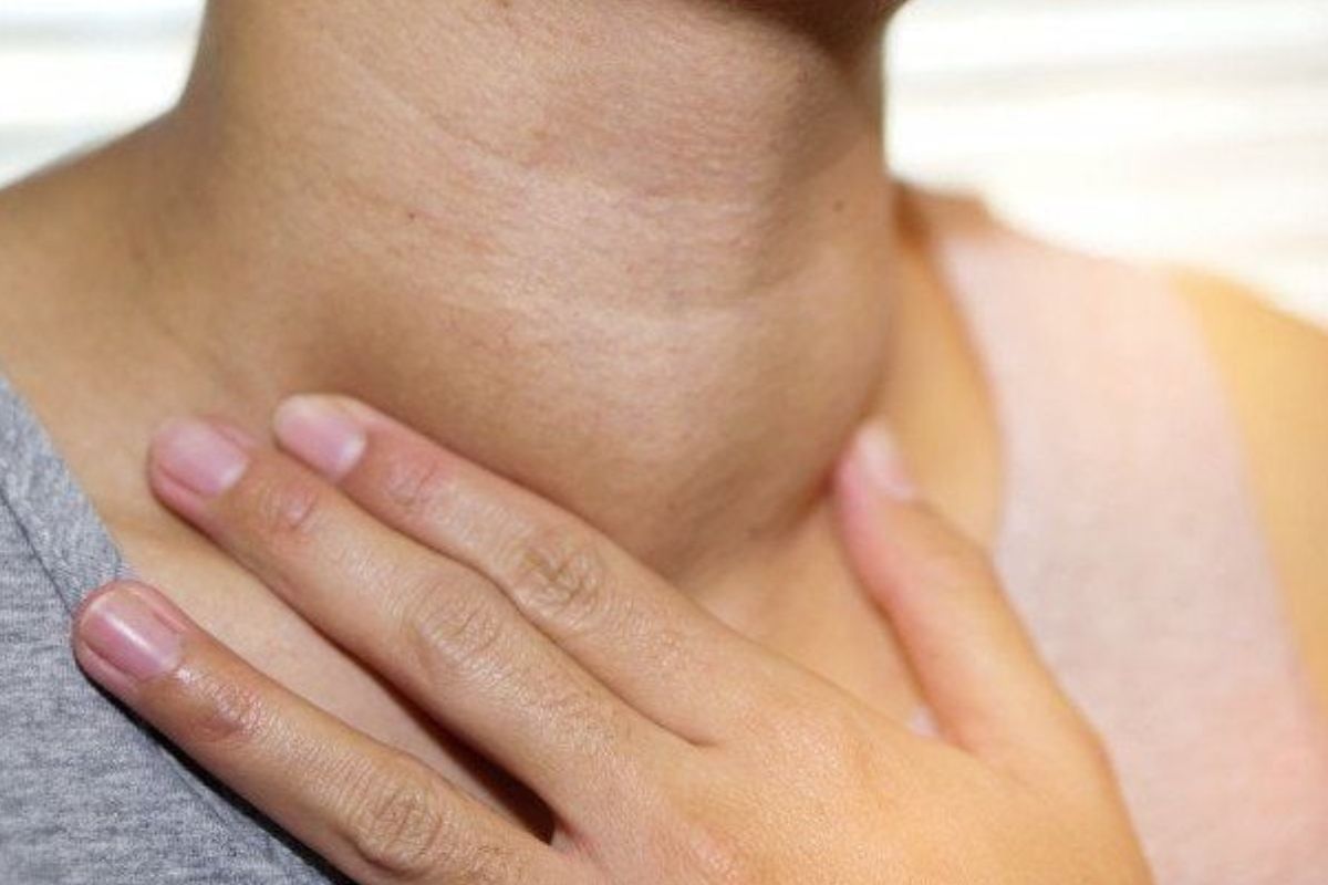 Cường giáp là bệnh gì