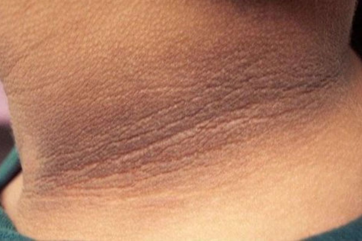 dấu hiệu cảnh báo tiền tiểu đường