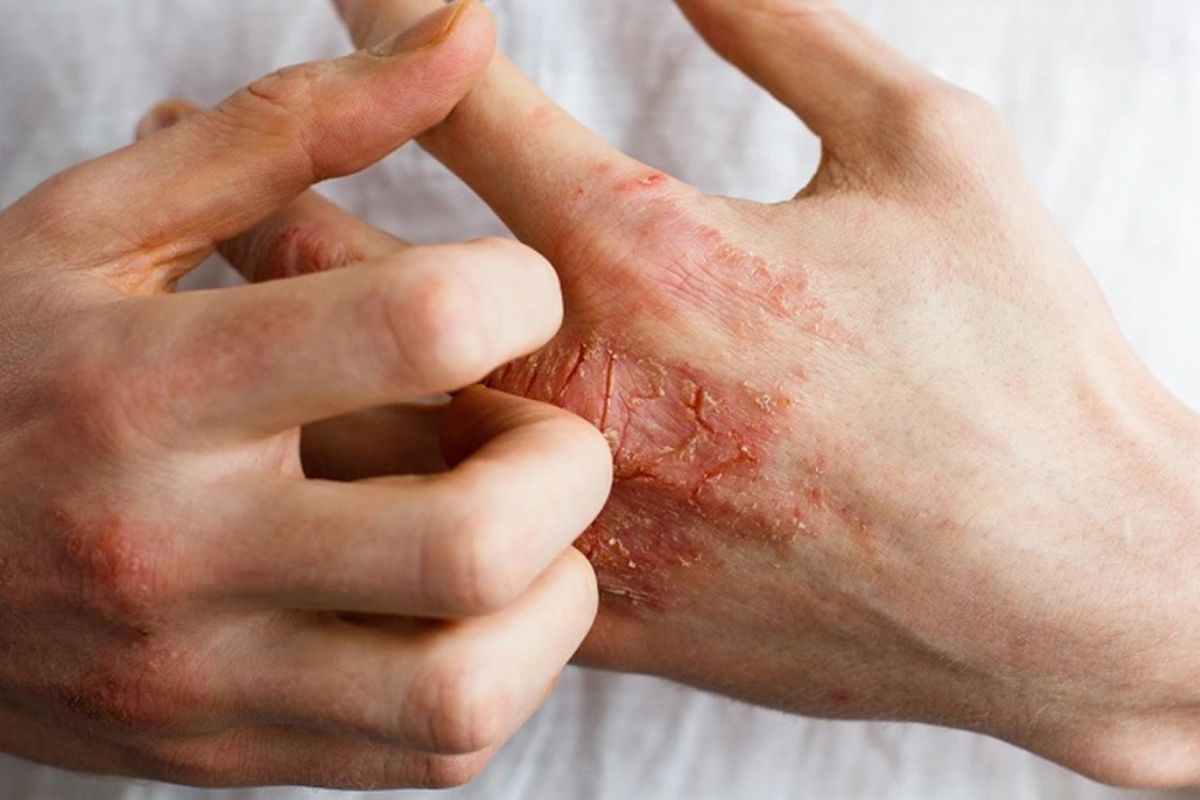 dấu hiệu bệnh tiểu đường