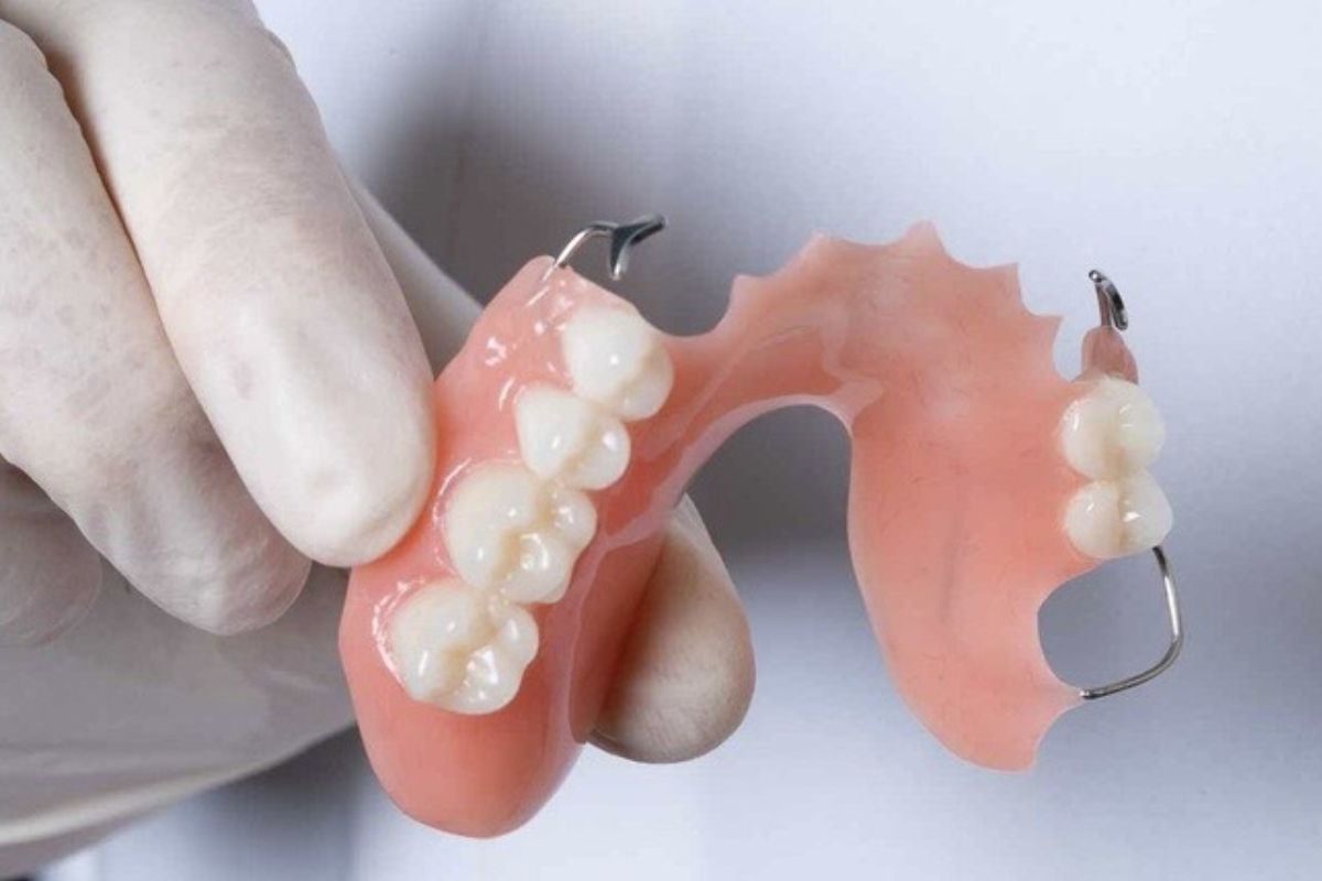 phương pháp hàm giả tháo lắp