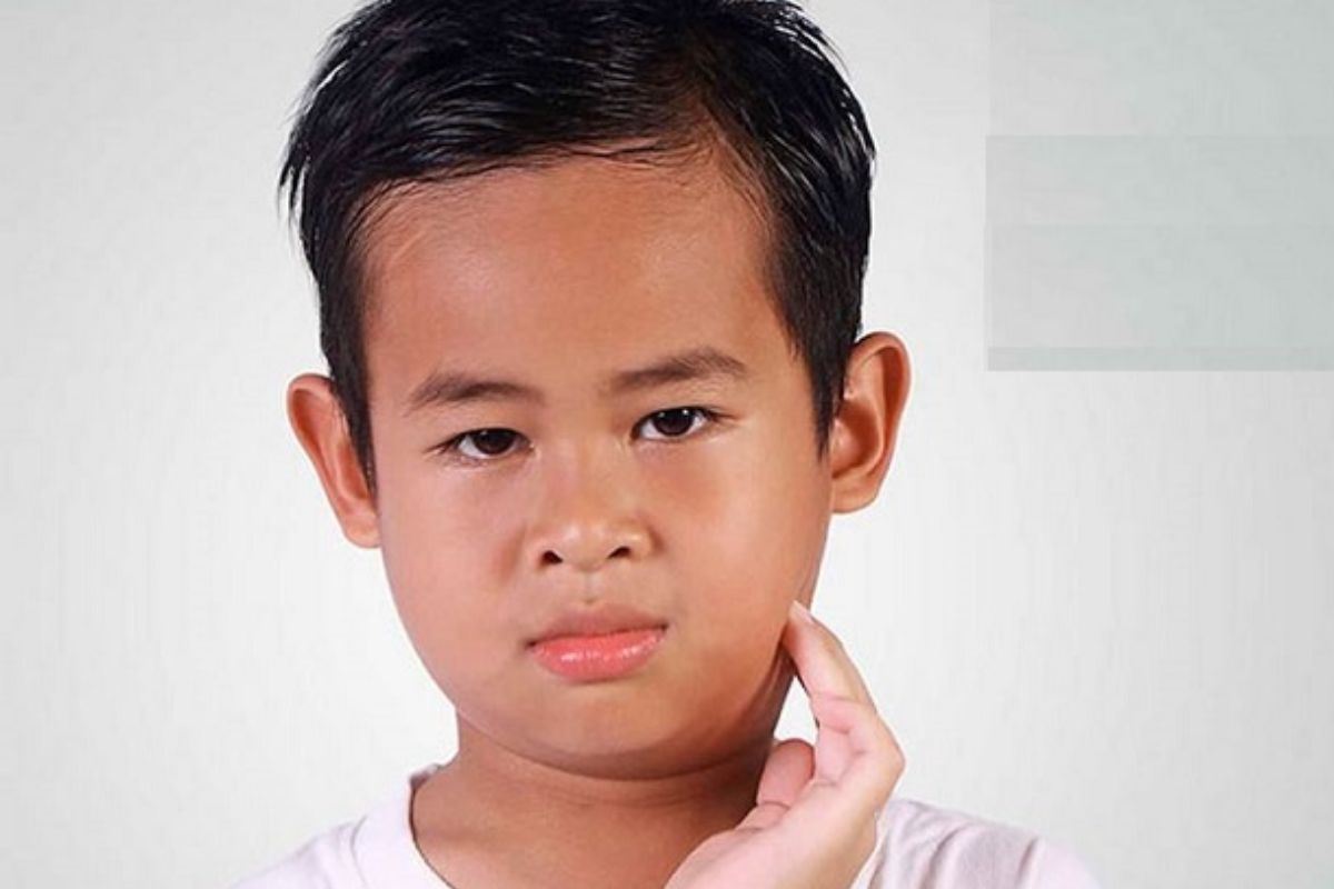 triệu chứng quai bị ở trẻ em